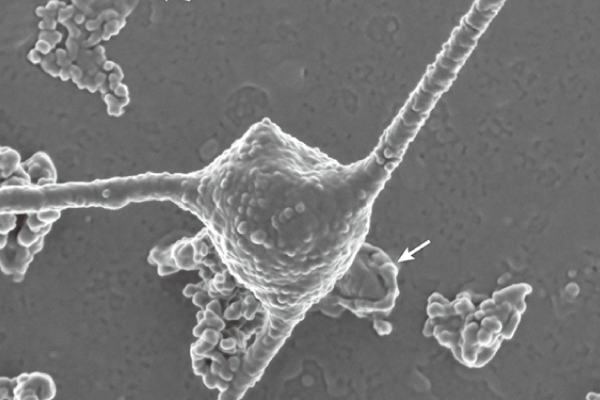 アーキア -深海の底からすくいあげた、 真核生物誕生のヒント-